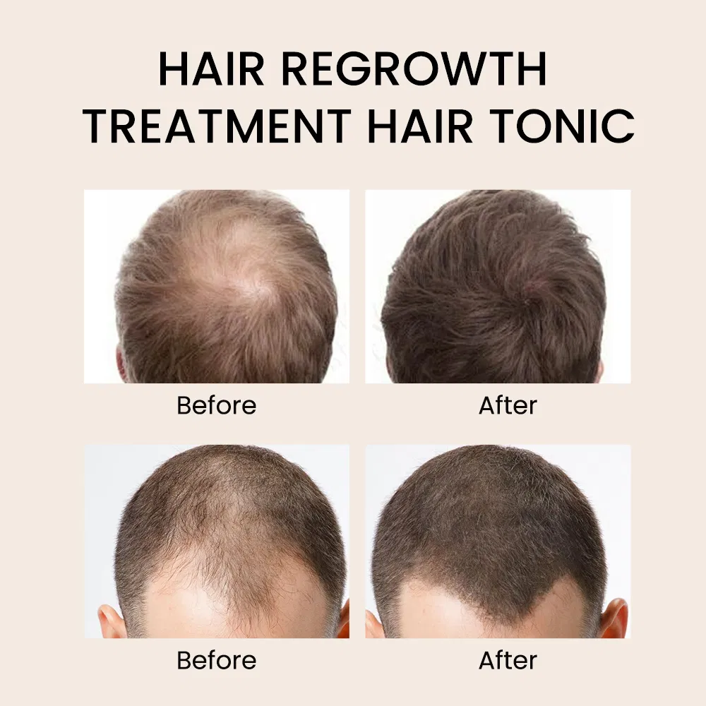 Private Label Hair Growth Serum for Hair Loss Treatment Serum Oil