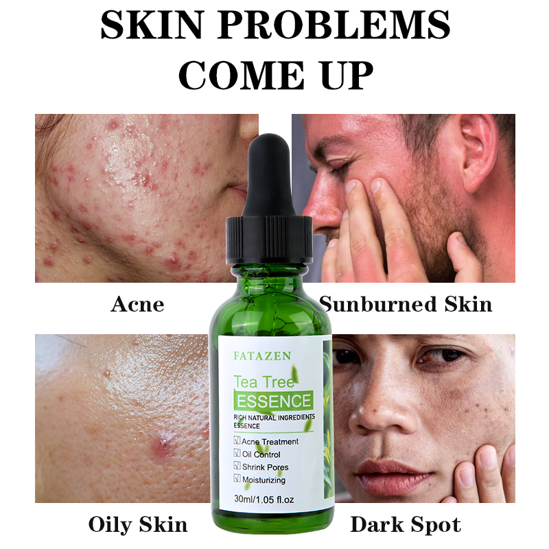 Brightening Green Tea Tree Anti-Acne Serum Whitening Hydrating Skincare Facial Essence