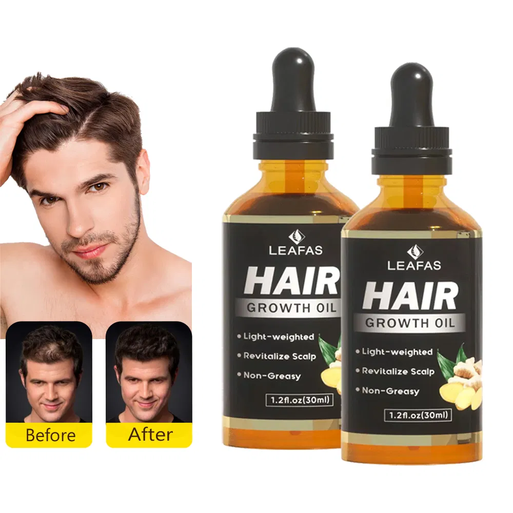 Custom Logo Natural Ingredients Hair Growth Oil for All Hair Types