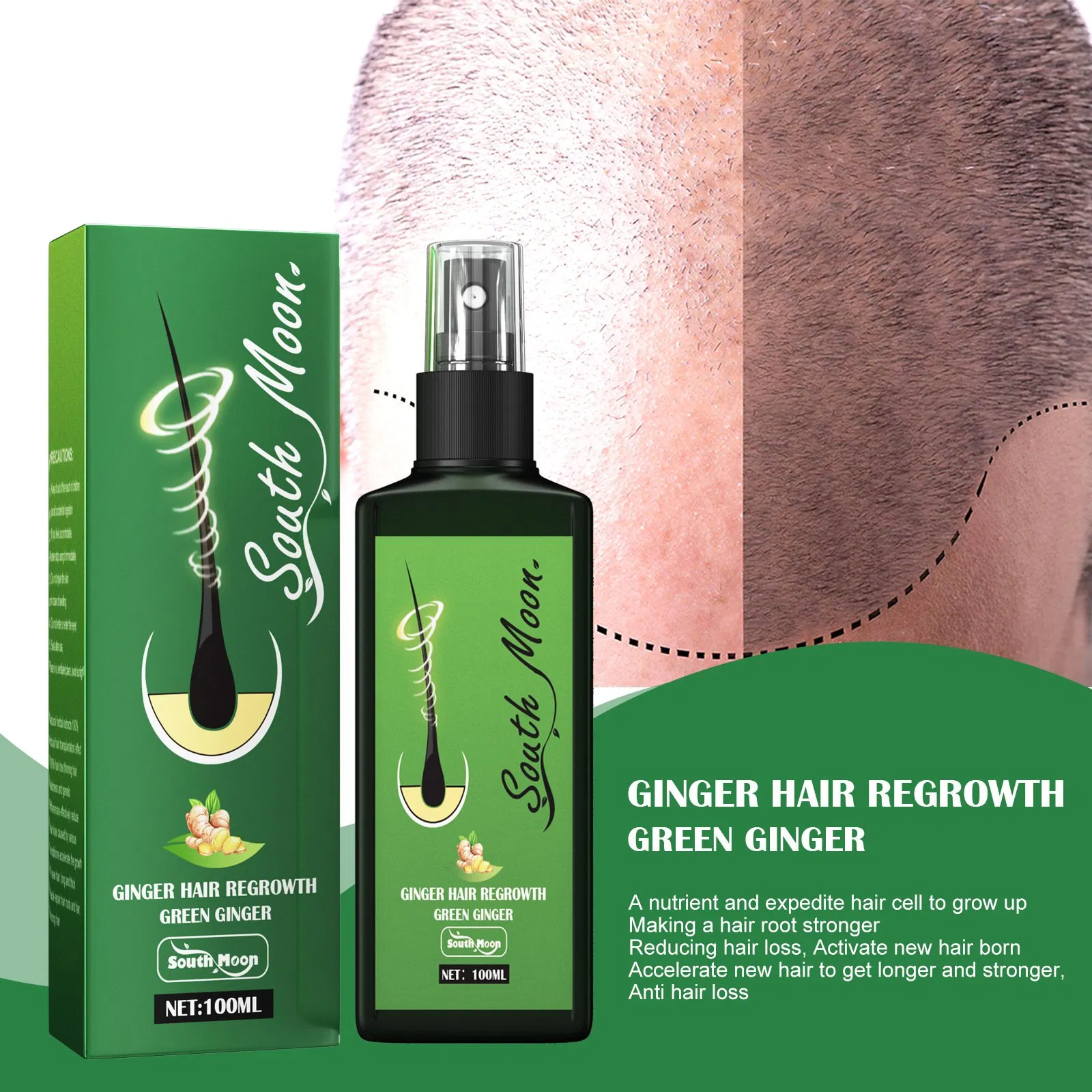 2024 Hair Growth Serum Private Label Ginger Hair Regrowth Redensyl Hair Growth Serum