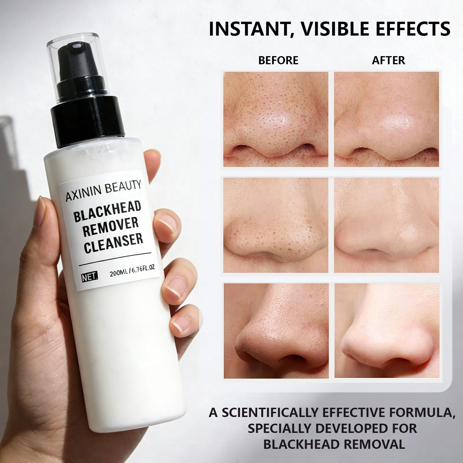 Beauty Cosmetics Skin Care Requlates Sebum Production Blackhead Remover Cleanser