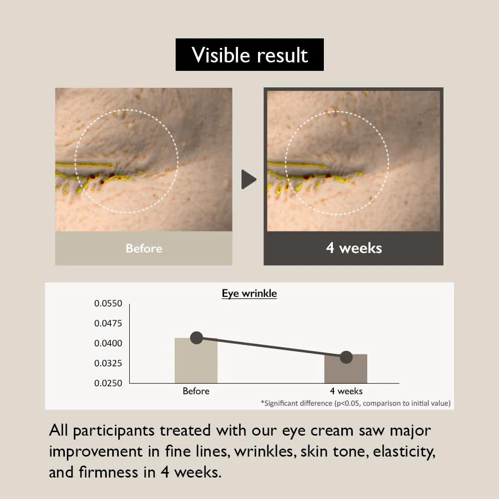 Natural Black Rice Bakuchiol Eye Cream Anti Aging Wrinkles Eye Bags Remover