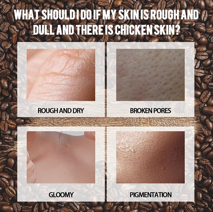 OEM Natural Skin Care Coffee Body Scrub for Stretch Marks Acne Cellulite