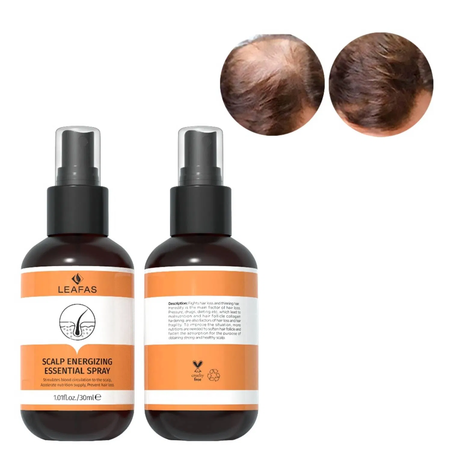 High Quality Professional Herbel Hair Oil Wholesale Bulk Hair Growth Oil
