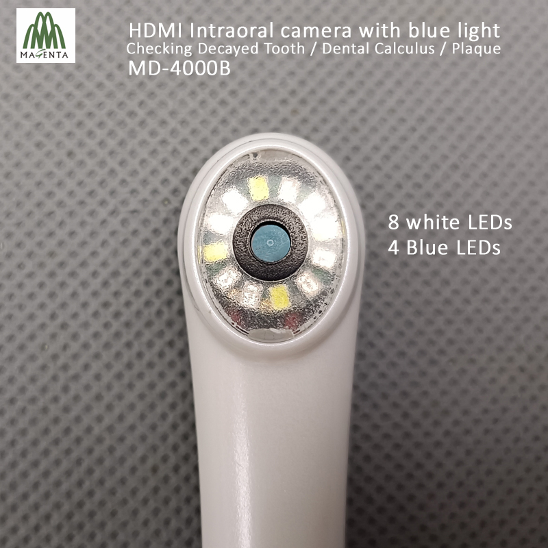 16: 9 Full Display HDMI and VGA Blue Light Dental Camera for Checking Dental Calculus / Decayed Teeth and Plaque