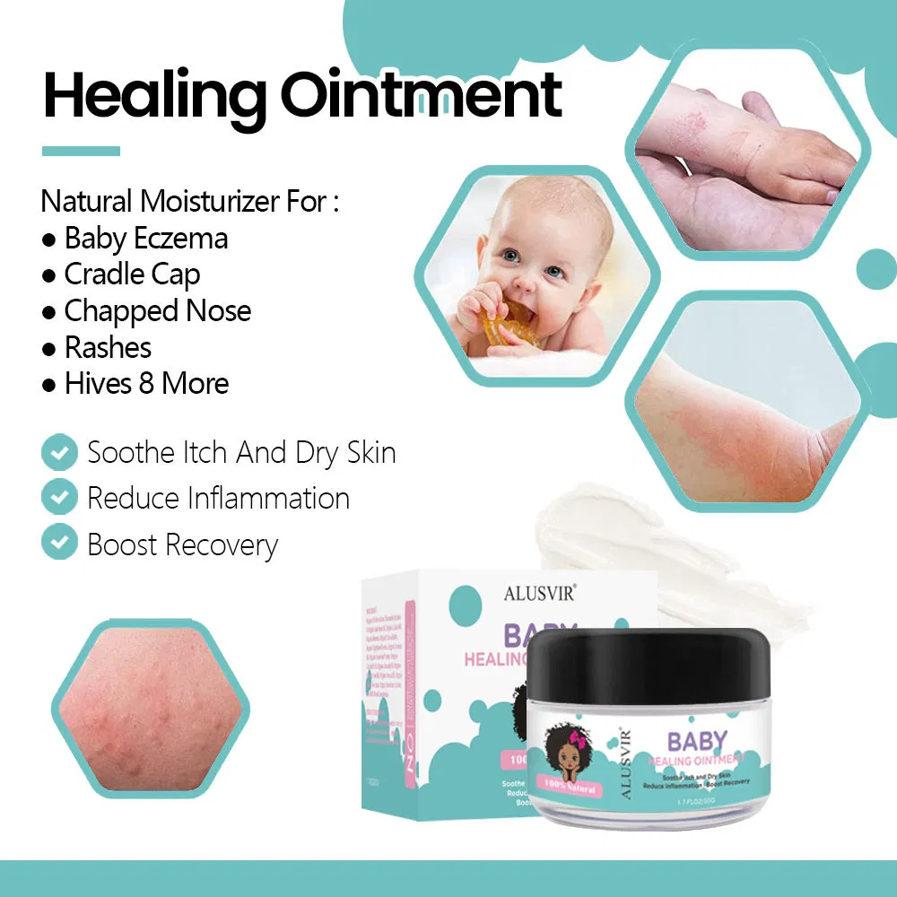 Baby Kids Body Lotion Soothe Itch Dry Skin Inflammation Eczema Rashes