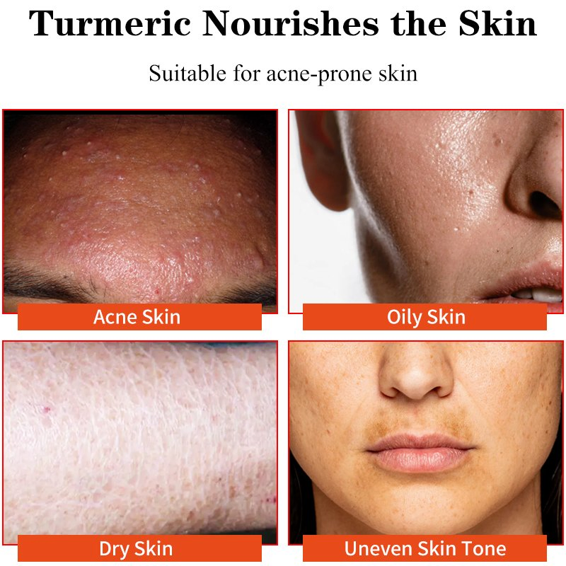 Acne Removing Fuxing Deep Cleansing Skin Mild Non-Irritating Whitening Turmeric Soap