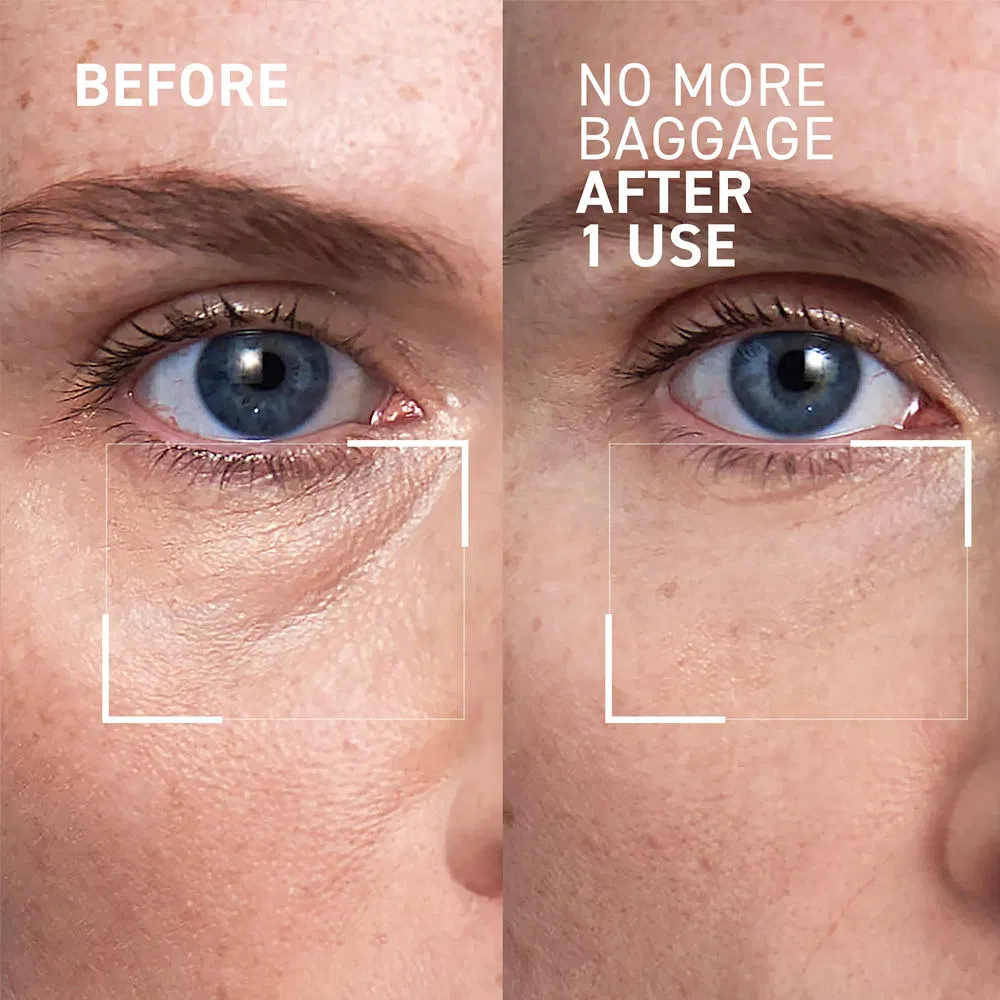 Niacinamide Dark Under Eye Circles Repair Anti Wrinkle Eye Bags Removal Cream