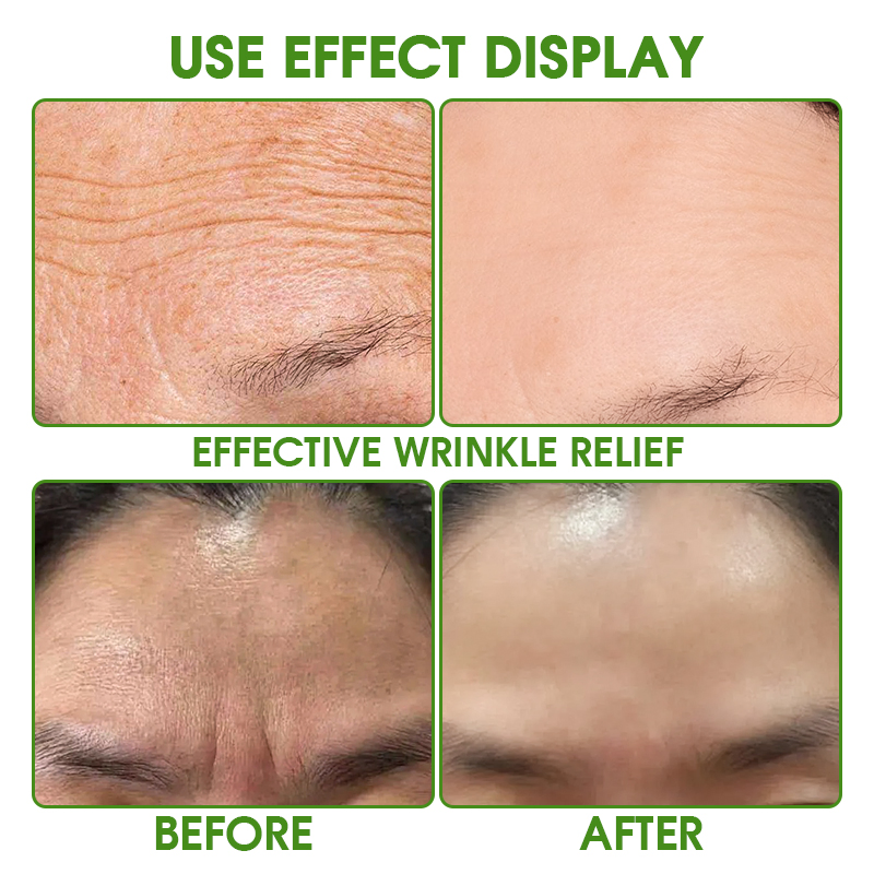 Forehead Wrinkle Patch Removal Lines Moisturizing Hydrogel Forehead Mask Organic