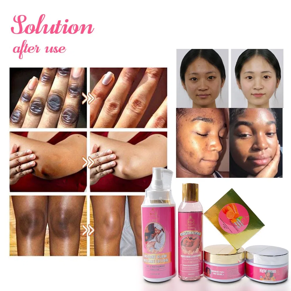 OEM/ODM Carotene Beauty Whitening Body Facial Treatment Set Vitamin C Vitamin E Skincare Set