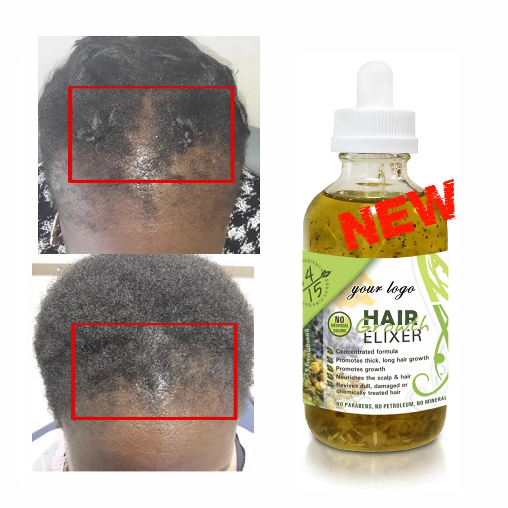 Castor Herbs Hair Oil Scalp Treatment Fast Regrowth Baby Hair Growth Oil