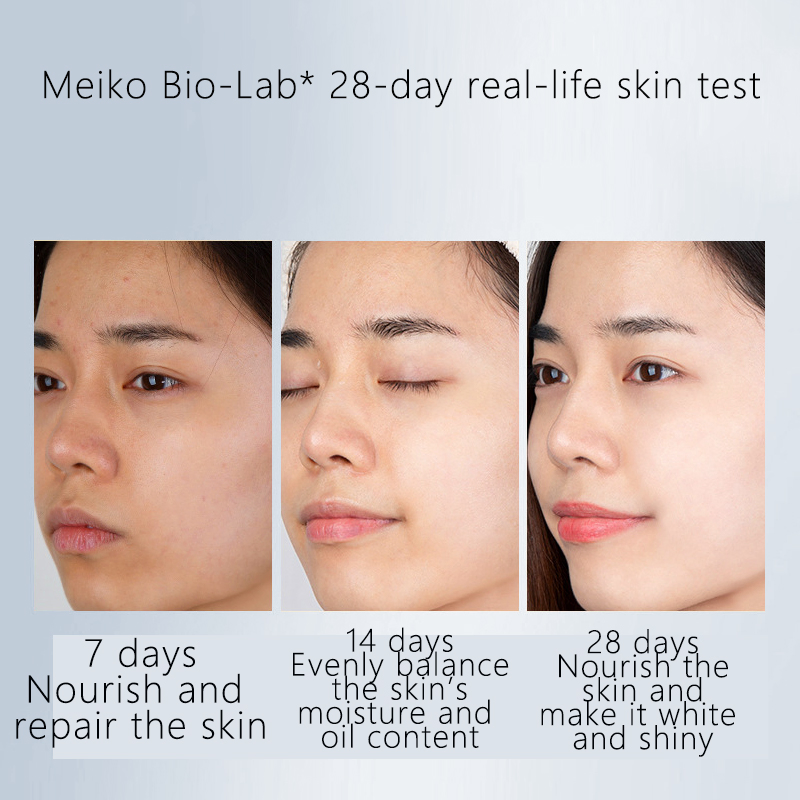 Skin Care OEM/ODM Lightens Spots Brighten Moisturize Niacinamide Cream