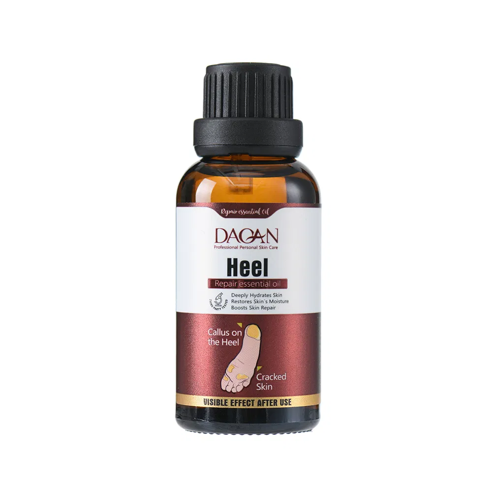 Coconut Essential Oil for Healing Dry Cracked Heels