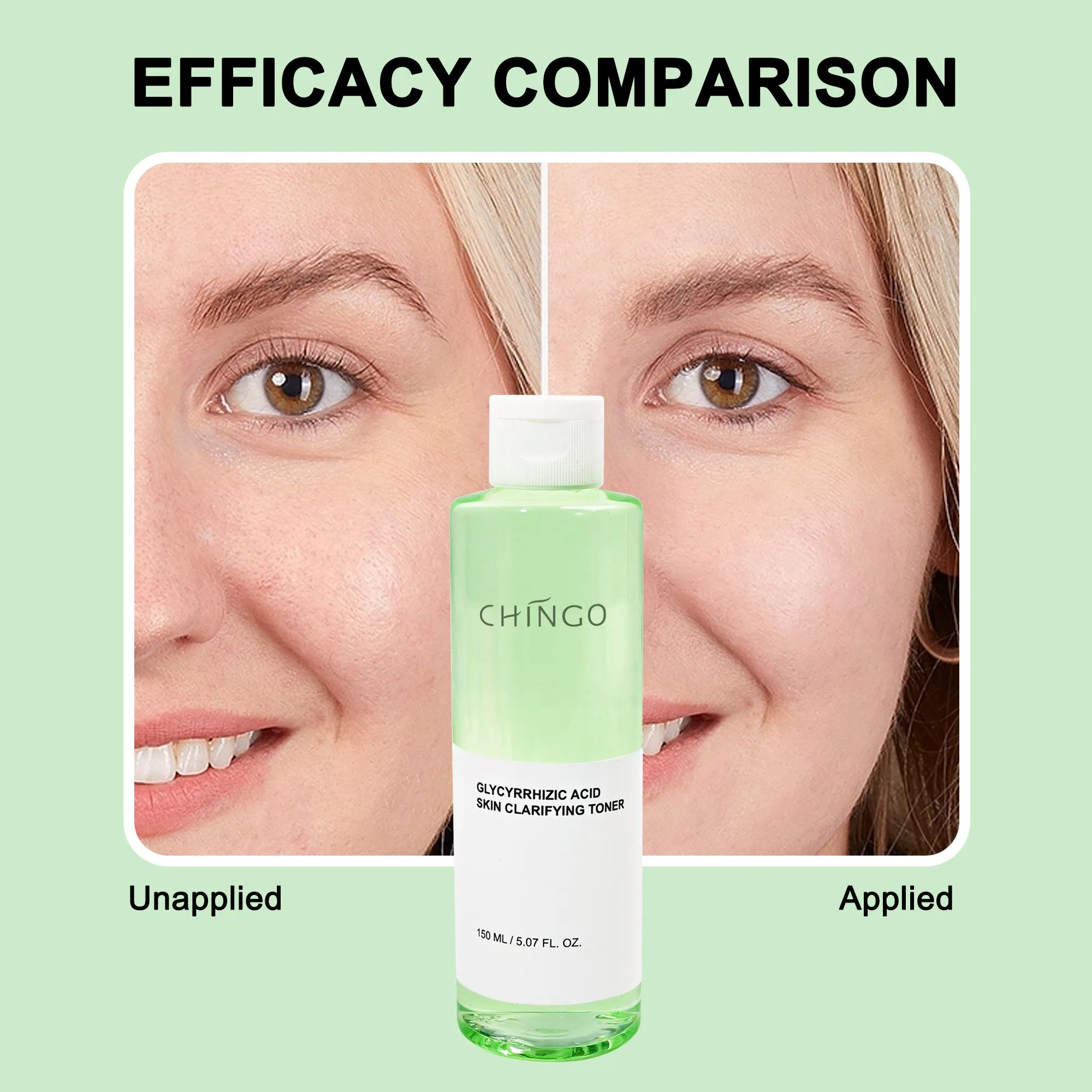 Natural Gentle Glycyrrhizic Acid Centella Facial Toner Soothing Irritation Barrier Balance