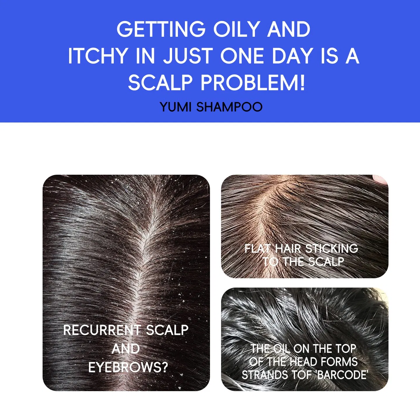 Professional Classic Clean Anti-Dandruff and Oil Control Hair Shampoo with Plant Extract