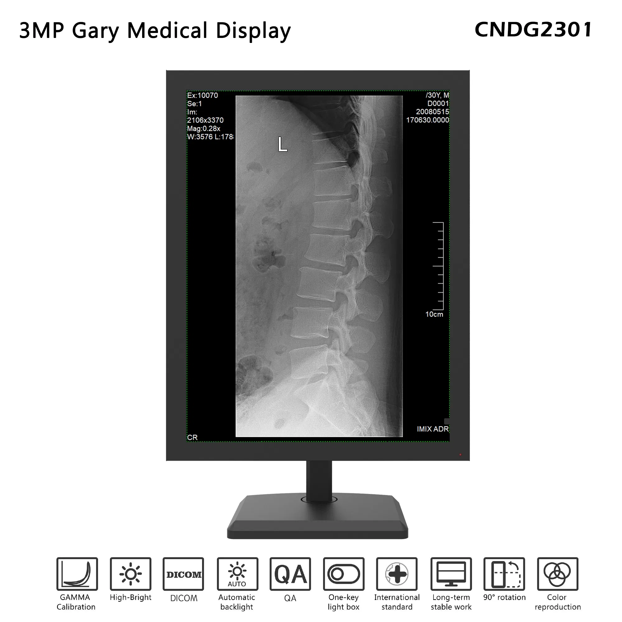 3MP 21.3 Inches Diagnostic Medical Display in Hospital Instrument