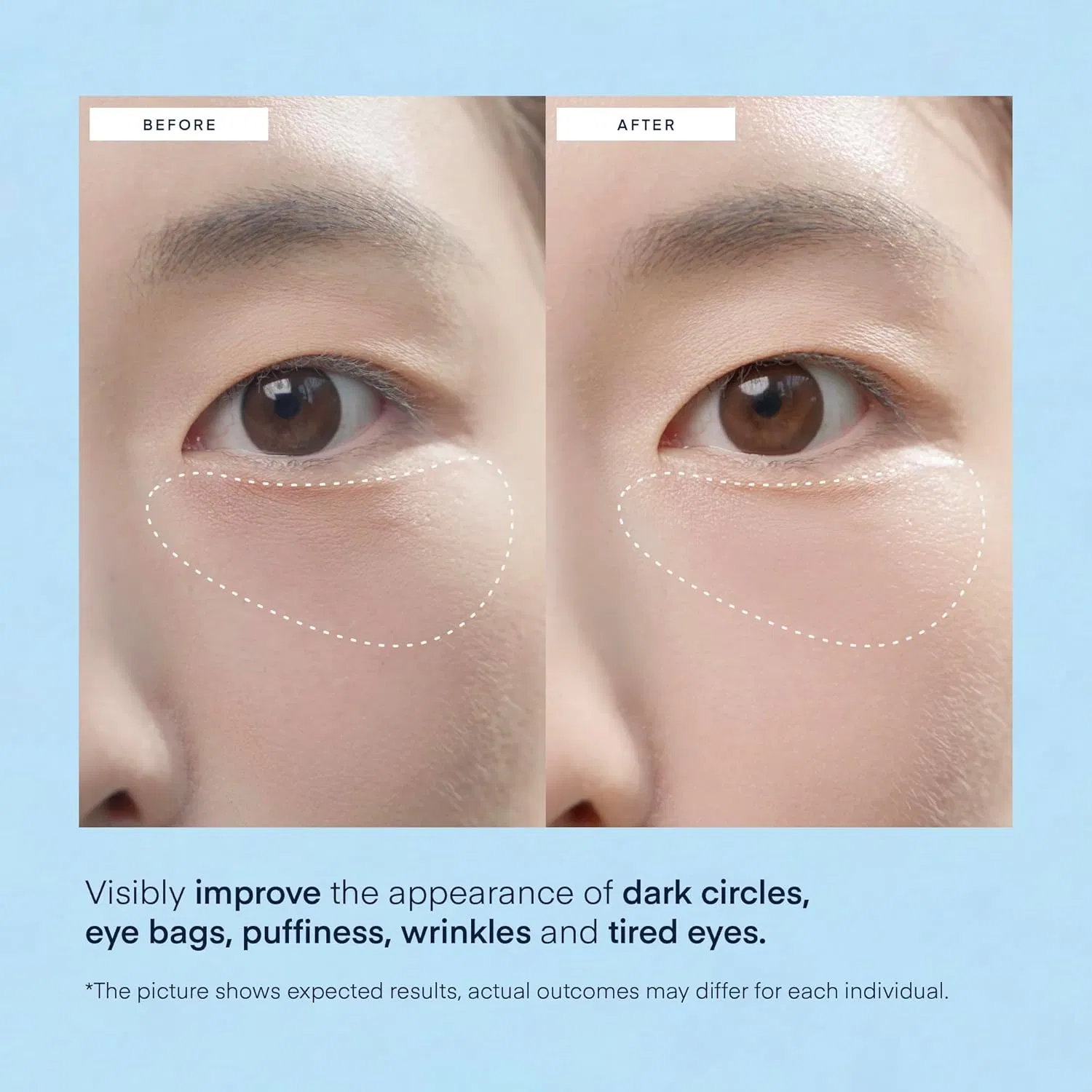 Collagen-Infused Eye Mask Plump Lift & Refresh Delicate Skin Eyemask