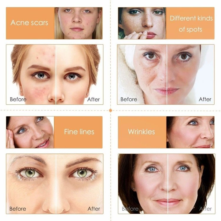 Vitamin C Brightening Kit Vitamin C Hydrating 5-Piece Vitamin C Kit Skin Care Set