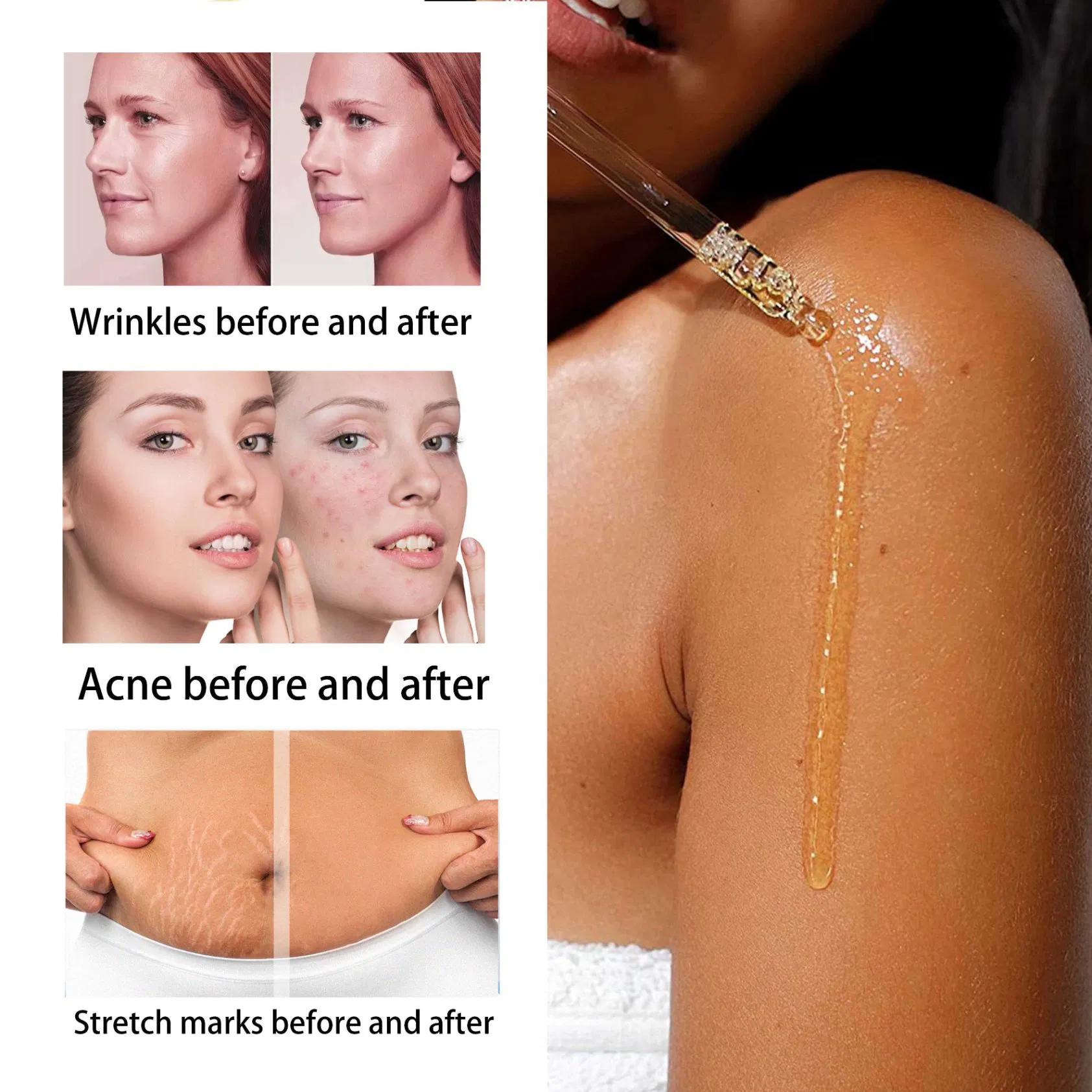 Roushun 7-Day Extra Whitening Face & Body Oil with Turmeric & Lemon1000ml