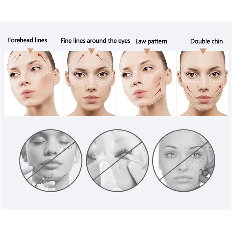 Protease Freeze-Dried Powder Skin Tightening Mask Beauty Salon Skin Rejuvenation Anti-Aging Lifting Firming Light Lines
