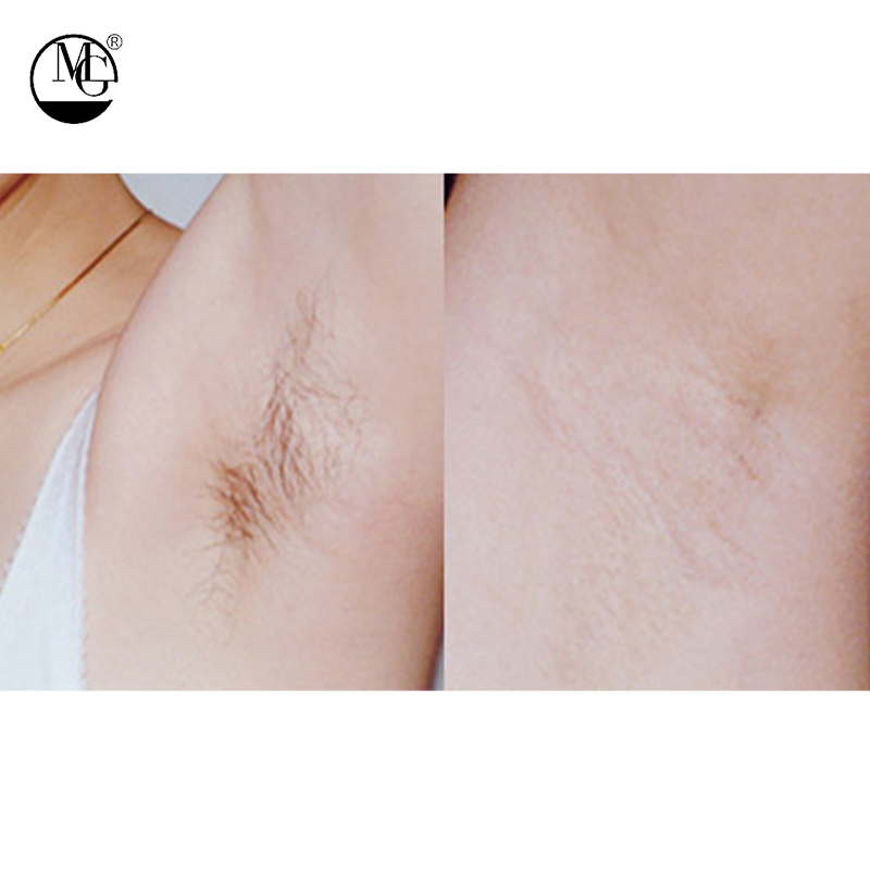 Women Ideal Sensitive Skin Private Label Hair Removal Cream