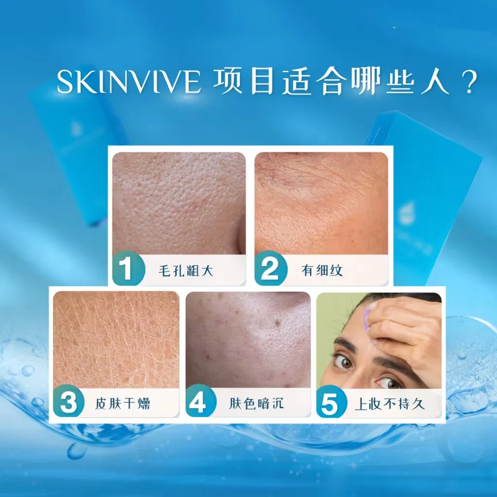 FDA Approves Skinvive Skin Booster Hyaluronic Acid (HA) Injection to Improve Rough Cheeks and Restore Smooth Skin