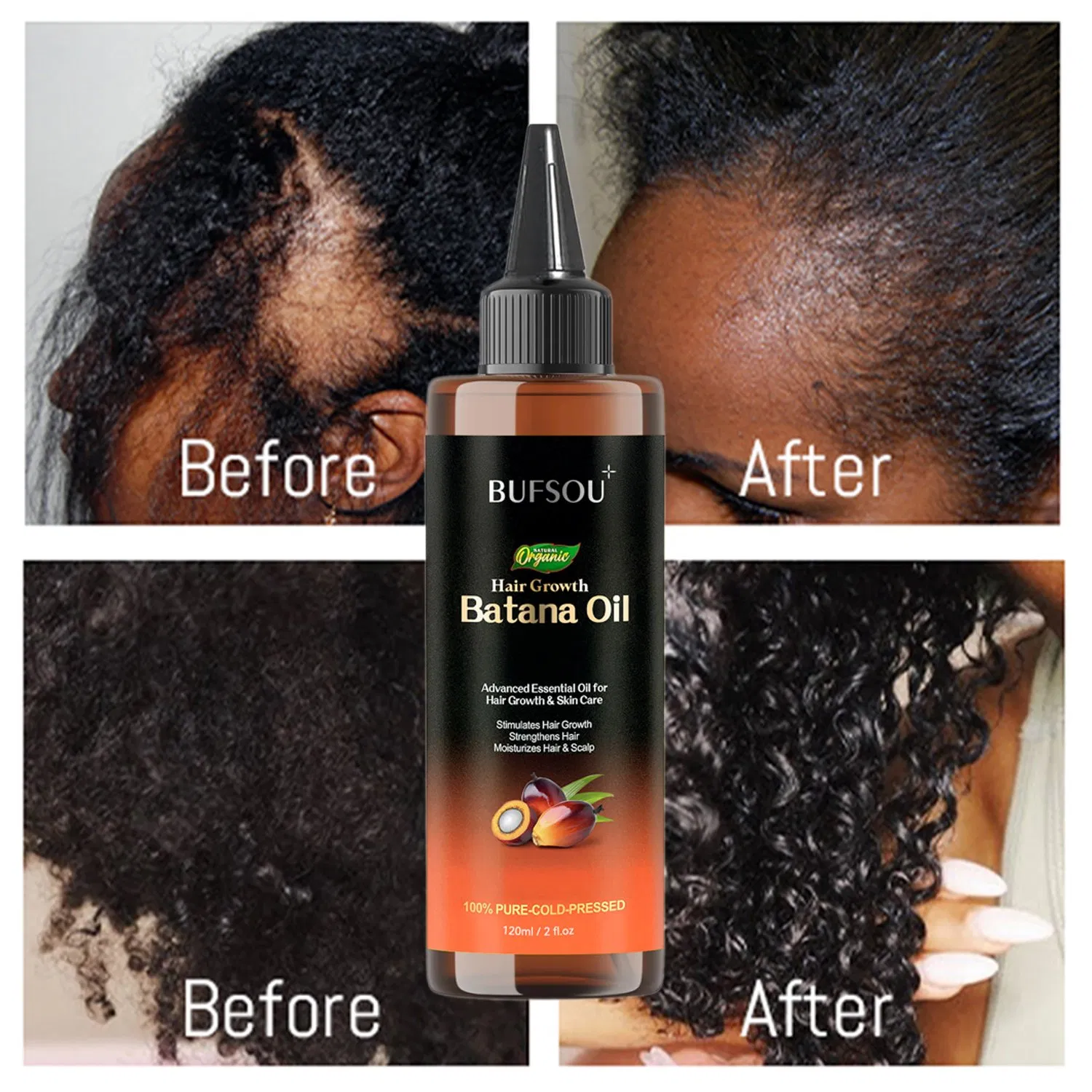 Hotsale in Africa Anti Hair Loss Natural Treatment Private Label Nourishing Organic Hair Growth Batana Hair Oil