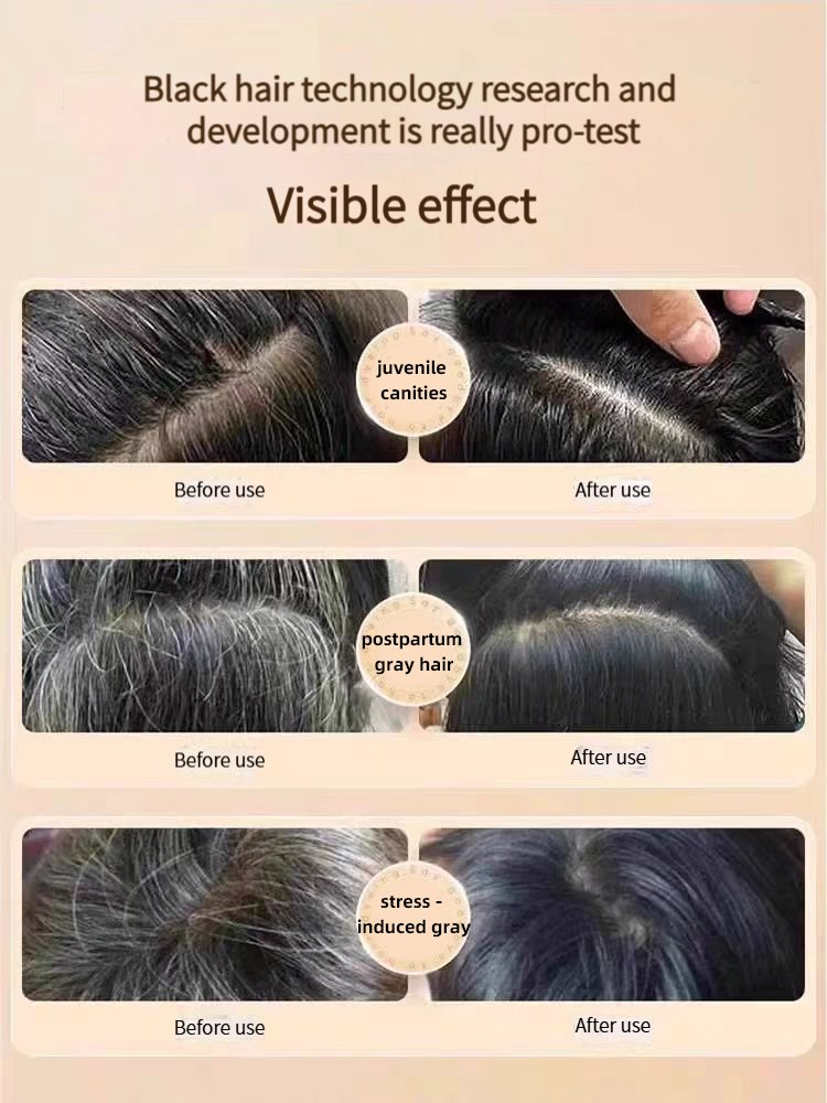 OEM Anti Hair Loss Shampoo for Oil Control and Nourishing