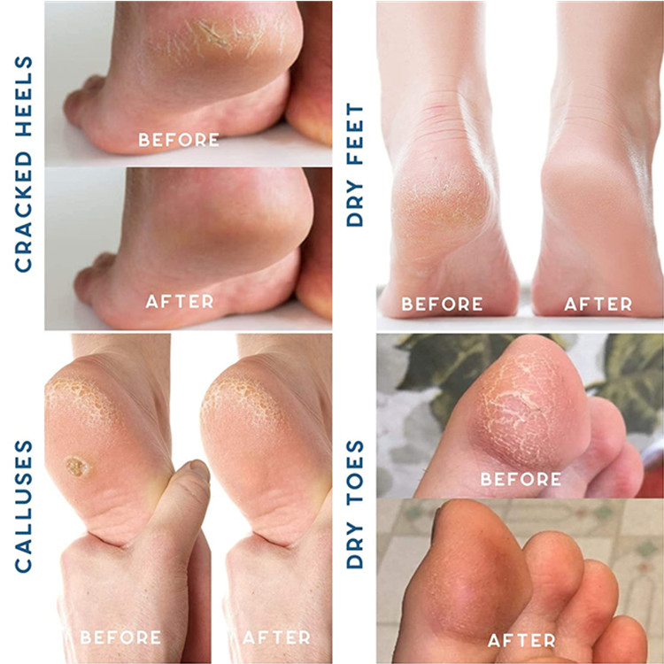 Vegan Foot Soak with Epsom Salt for Muscle Relief and Tired Feet