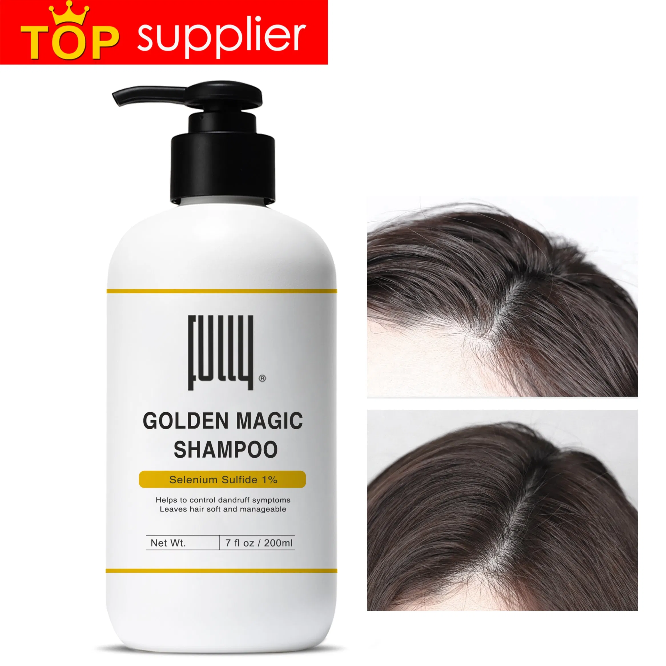 Support Customized Selenium Sulfide 1% Anti-Dandruff Shampoo Relieves Itching Anti Dandruff Shampoo