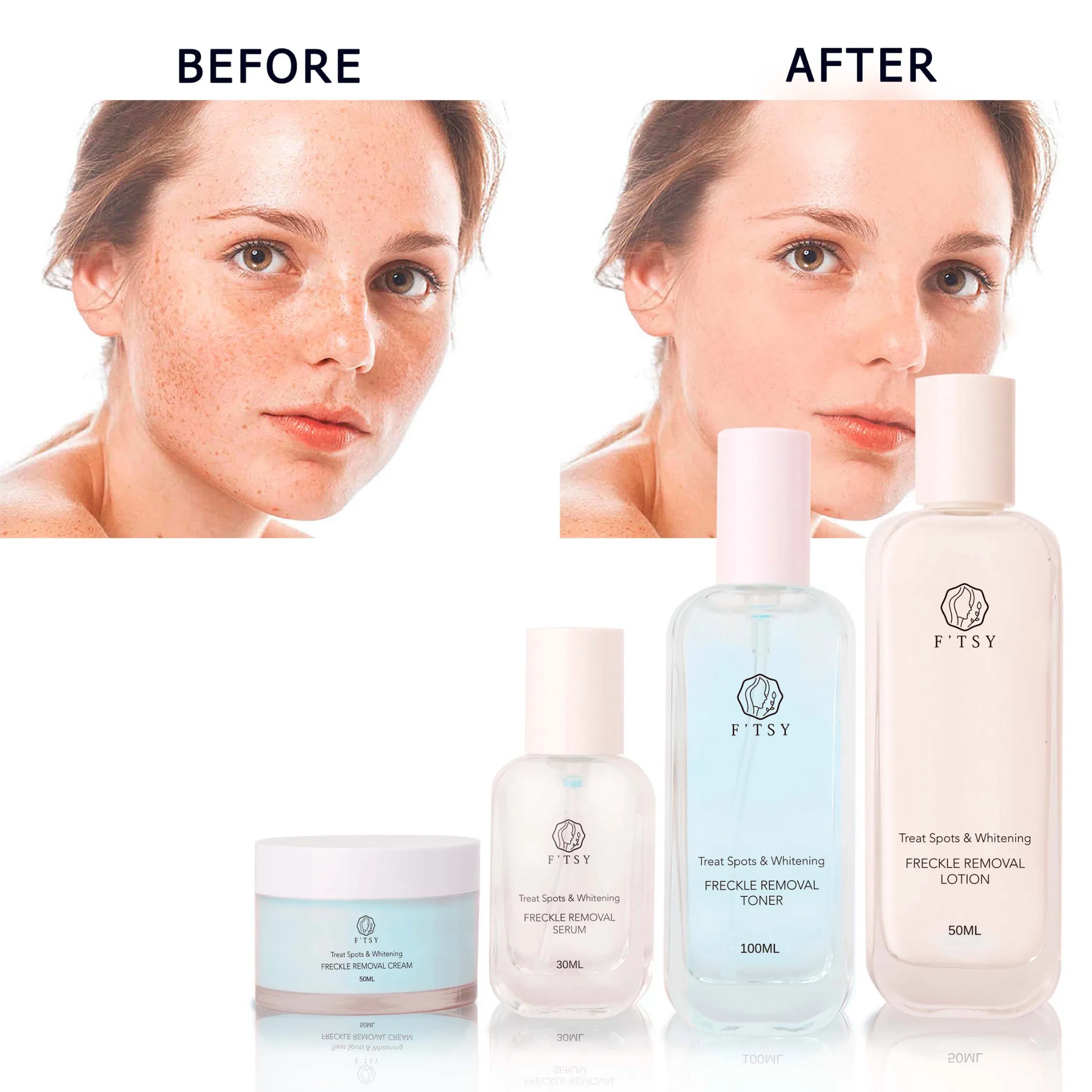 Private Label Freckle Removal Kit Natural Hydrating Moisturizing Skin Care Set