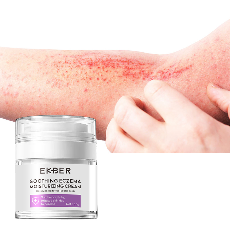 Private Label Soothing Eczema Moisturizing Cream Chinese Herbal Moisturizer Relieves Eczema-Prone Skin