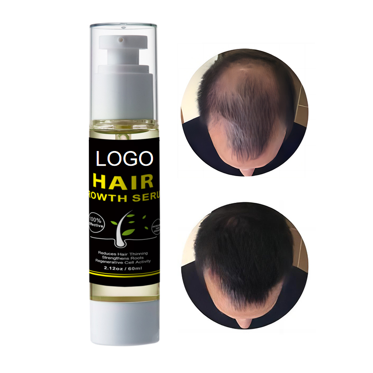 Factory Price Custom Logo Private Label Biotin Aid Hair Growth Anti-Loss Ingrown Hair Growth Serum