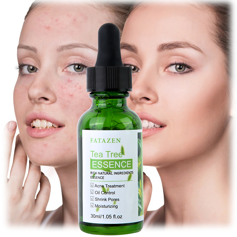 Brightening Green Tea Tree Anti-Acne Serum Whitening Hydrating Skincare Facial Essence