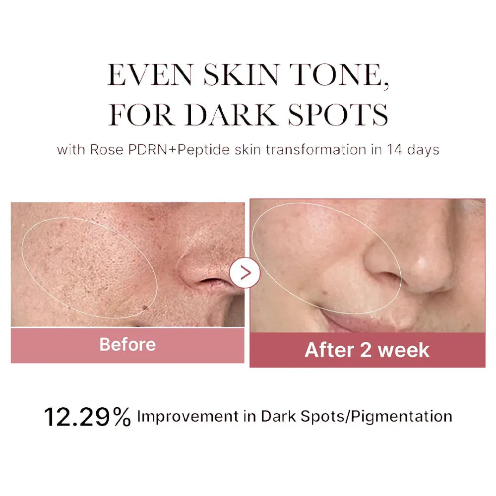 Rose Pdrn Niacinamide Peptide Anti Aging Whitening Facial Toner