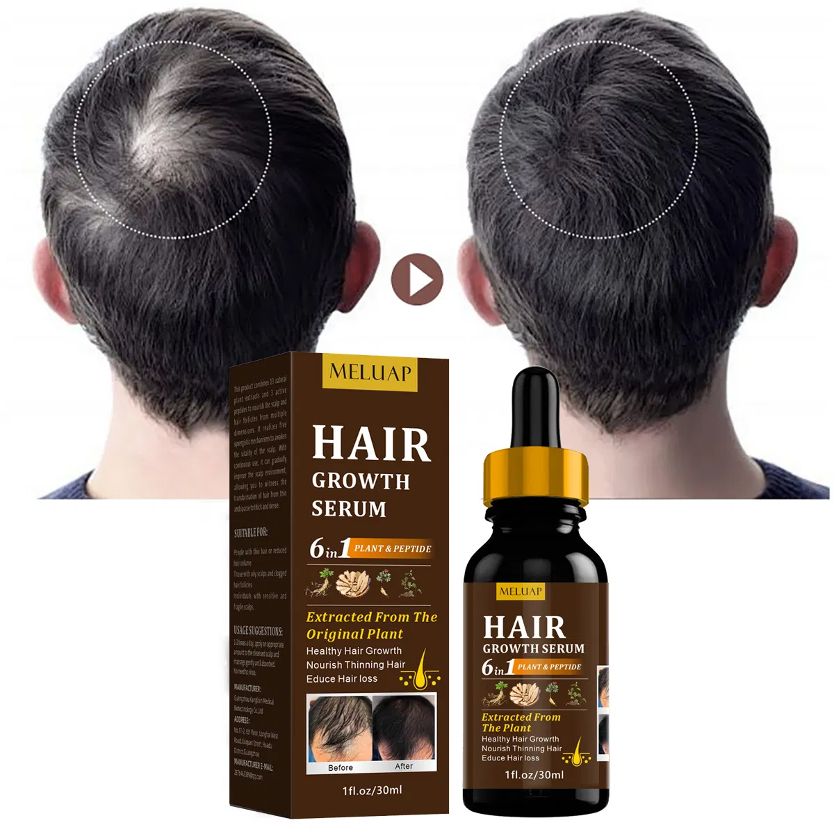 Organic Vegan Nourishing Scalp Anti Hair Loss Treatments Growth Hair Regrowth Oil