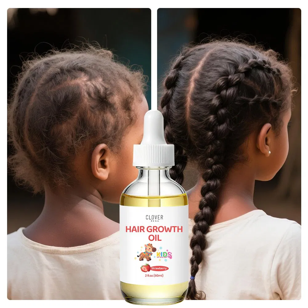 OEM ODM Natural Curly Hair Growth Oil for Kids Black Hair with Rosemary & Ginger Coconut Oil Refreshing Dry Scalp Treatment