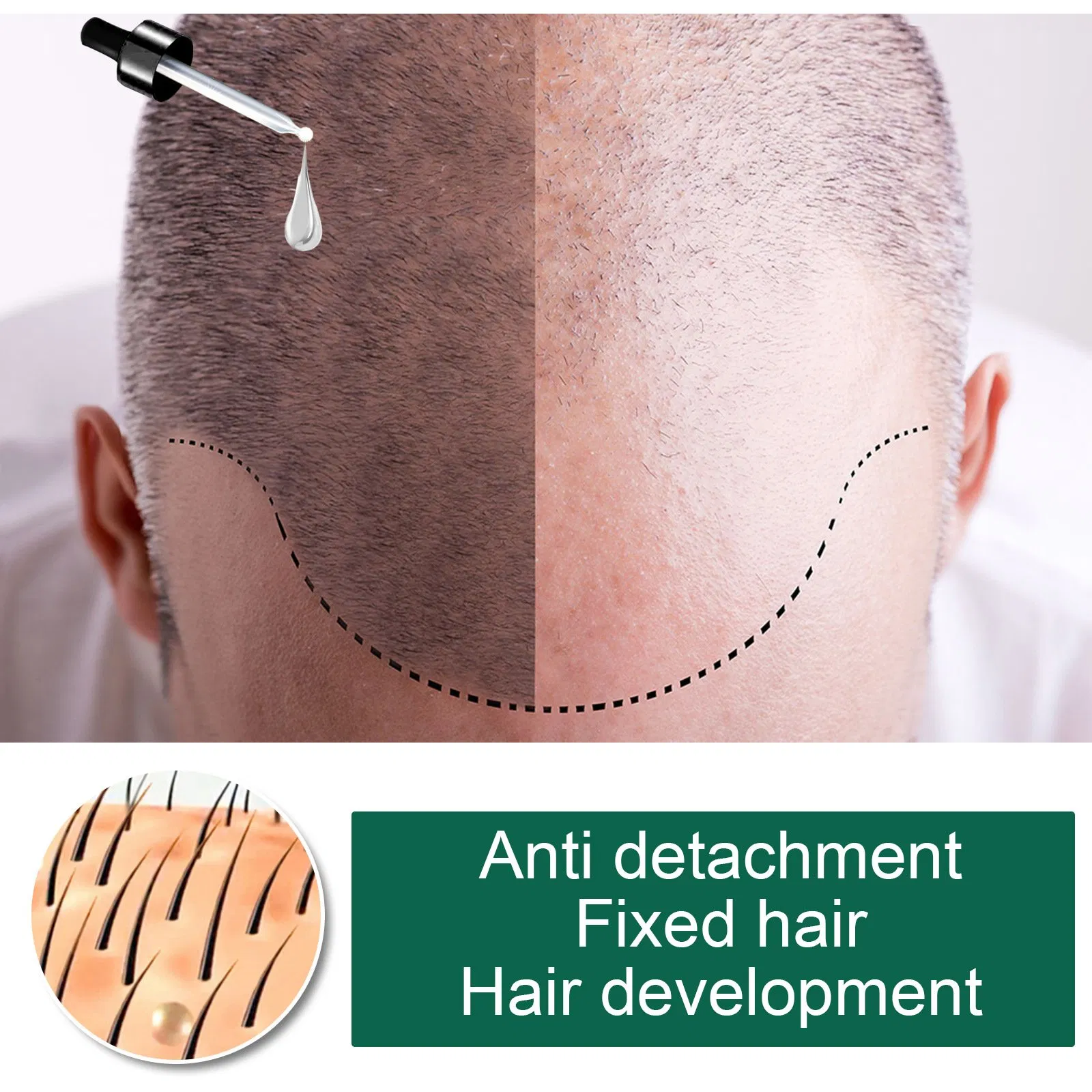 5 Days Anti Hair Loss Prevent Baldness Treatment Fast Growing Nourish Dry Damaged Ginger Hair Care Essential Oil