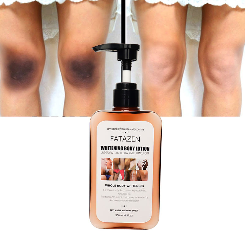 Fatzenskin Care Products Organic Arbutin Skin Whitening Exfoliating Cream Anti Dark Spot Moisturizing Whitening Body Lotion