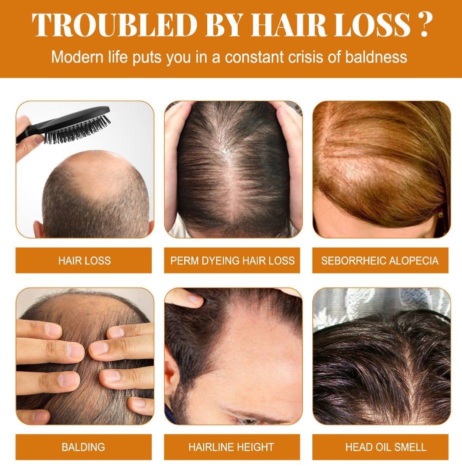 Online Wholesale and Retail Horse Oil Shampoo Professional Oil Control Nourish Anti Hair Loss Shampoo Improve Shine Enhancing Shampoo No Silicone Oil Hair Care