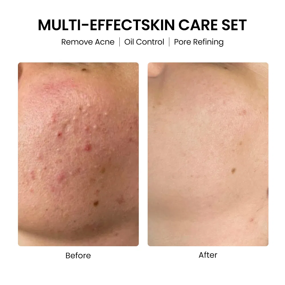 Koran Cosmetics Organic Skin Care Products Whitening Moisturizing Anti Aging Face Serum Cream Skin Care Set Manufacturers
