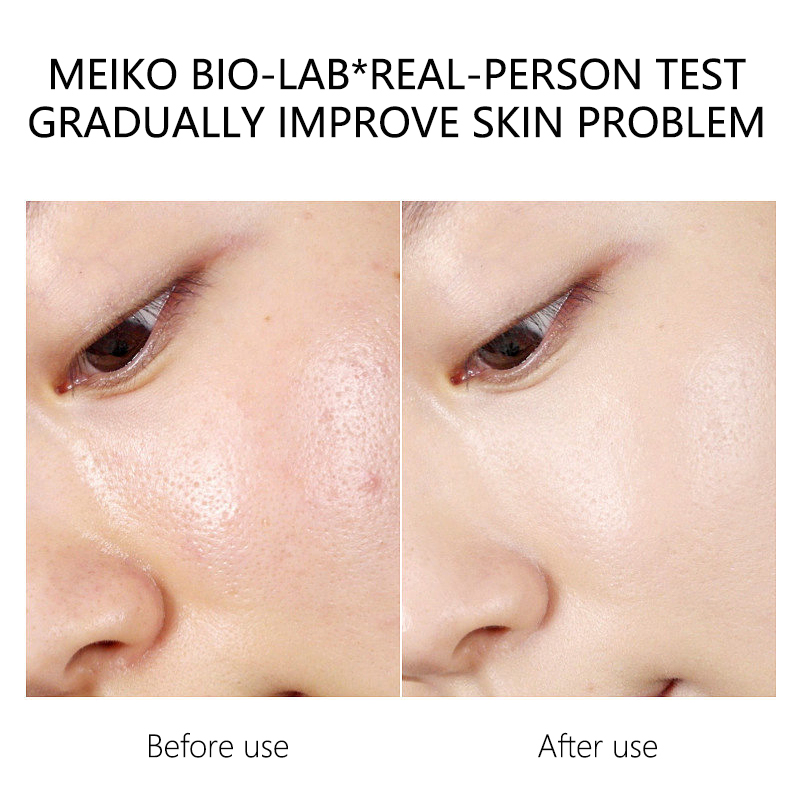 Skin Care OEM/ODM Repairing Hydrating Lighten Dark Spots Elasticity Rejuvenation Facial Mask