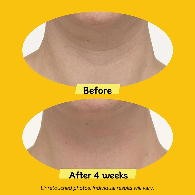 OEM Private Label Organic Firming Smoothing Neck Cream Anti Aging Wrinkle Elastic Neck Moisturizing Cream