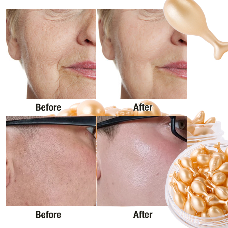 Anti Wrinkle Vitamin E Serum Skincare Whitening Pore Shrinking Facial Essence Capsule