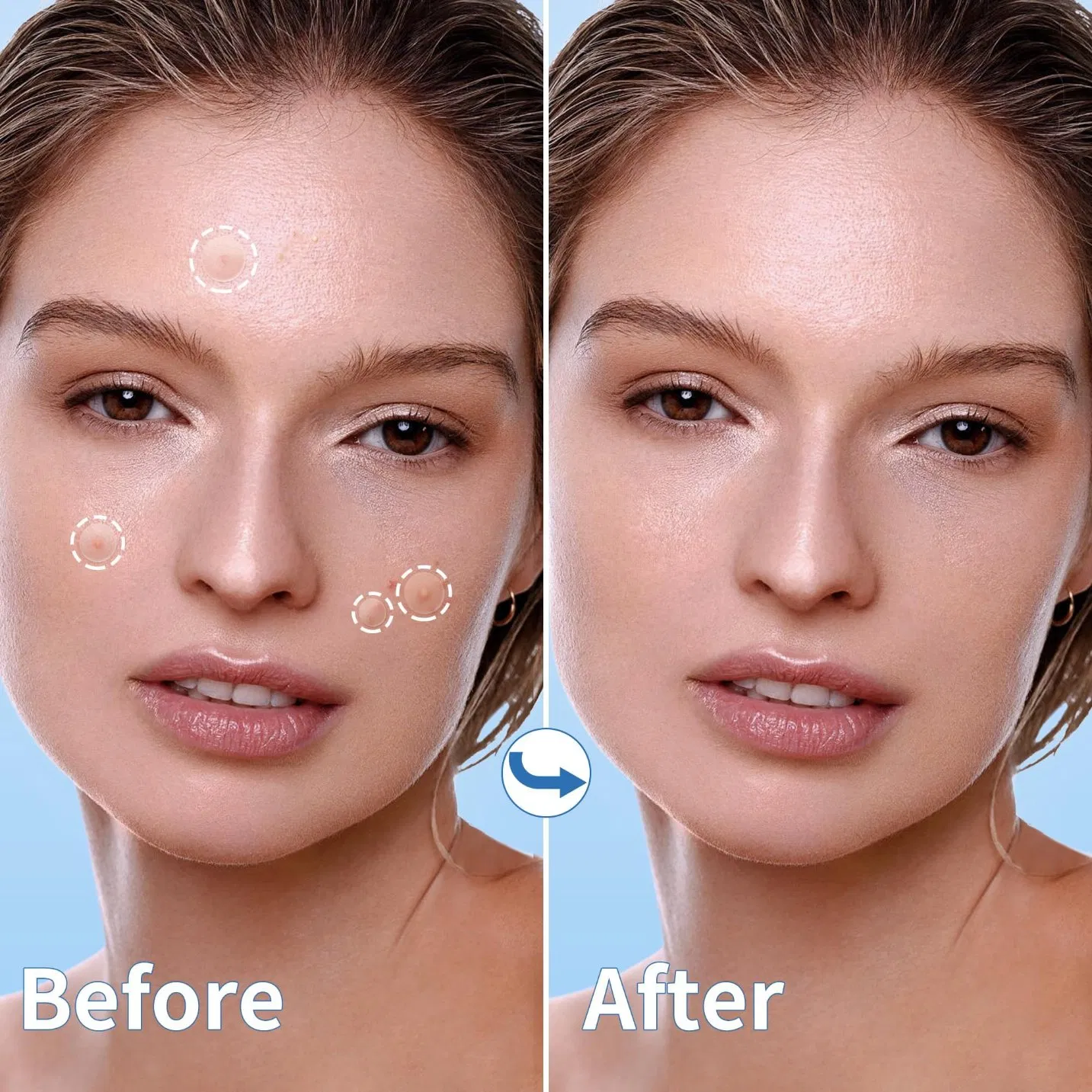 Beauty Care Sheet Mask Pimple Patch for Face Salicylic Acid Pimple Patches