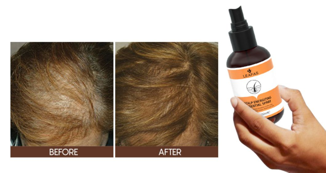 Private Label Anti Hair Loss Hair Growth Oil