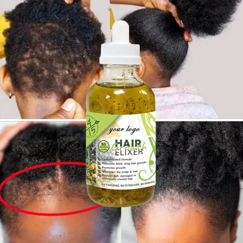 OEM Organic Rosemary Castor Almond Scalp Care Serum Hair Treatment Growth Oil