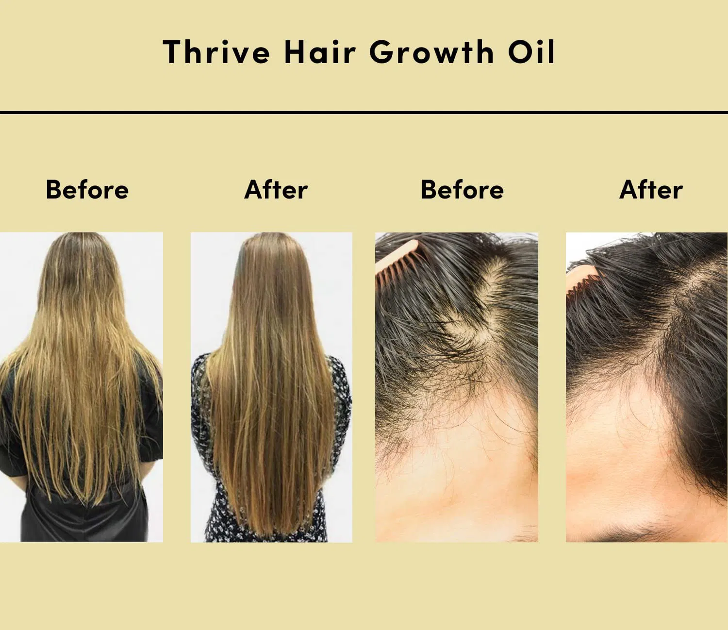 12 Herbs Blend Argan Rosemary Oils Mega Growth Elixir Natural Organic Hair Treatment Rosemary Oil for Hair Growth