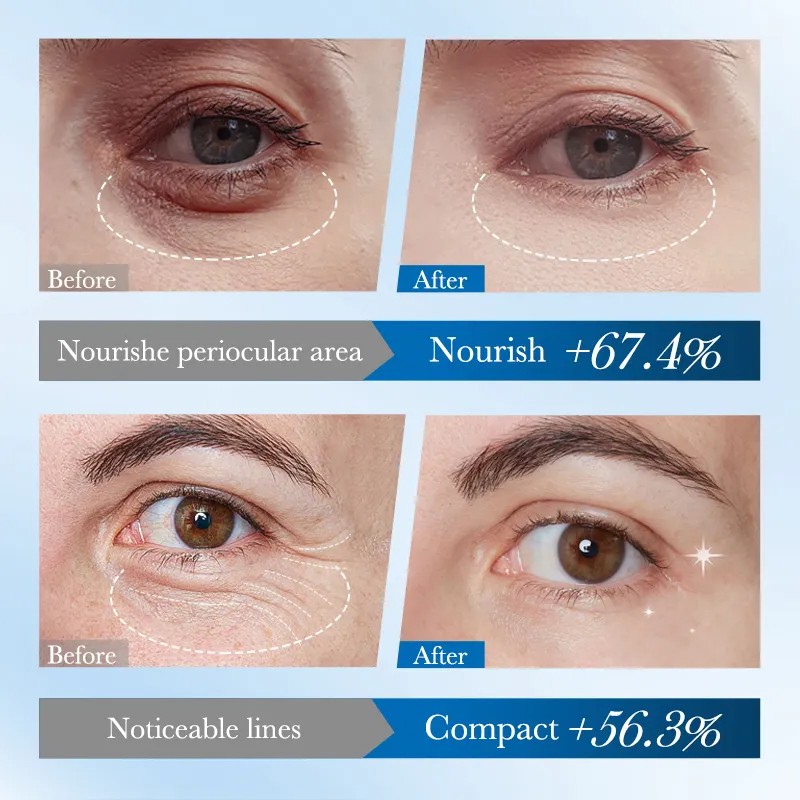 Ditong Private Label Skin Care Manufacturer Blueberry Moisturizing Firming Eye Mask Moisturizing Eye Patch