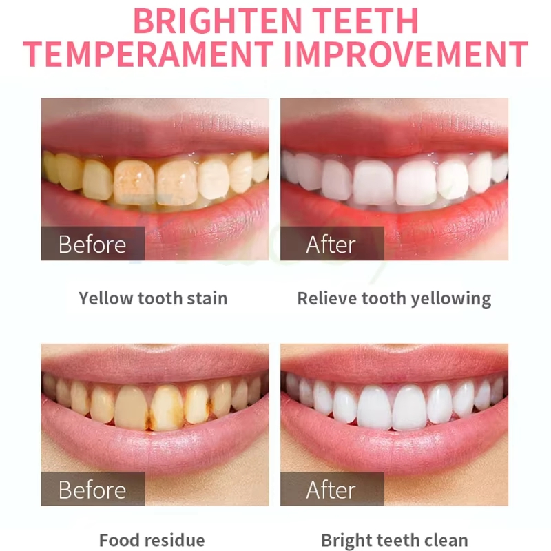 Private Label Peach Grape Lvint Lvouth Oral Cleaning Teeth Whitening Fresh Breath Mouthwash 500ml Portable for Home Travel Hotel